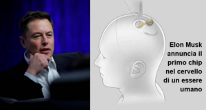 Elon Musk annuncia il primo Chip nel cervello di un essere umano